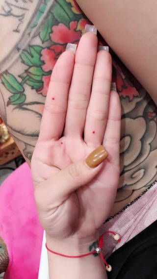 Hứng vận đen vì xăm nốt ruồi phú quý