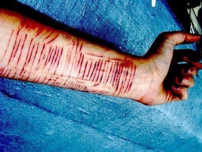 Không chỉ bóc da tay như Hương Tràm, giới trẻ Việt còn nhiều cách ngược đãi bản thân kinh hoàng hơn