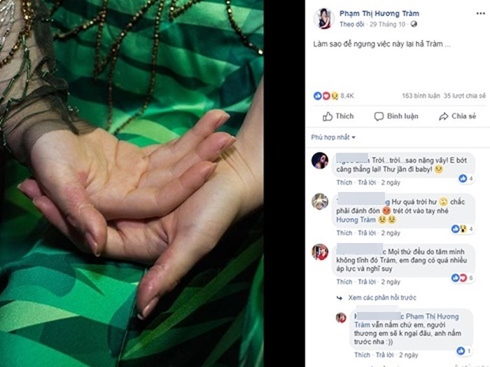 Không chỉ bóc da tay như Hương Tràm, giới trẻ Việt còn nhiều cách ngược đãi bản thân kinh hoàng hơn