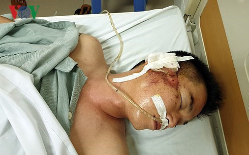 Đã tìm ra đối tượng lái xe Mazda CX5 bắn súng, chèn xe qua người lái taxi