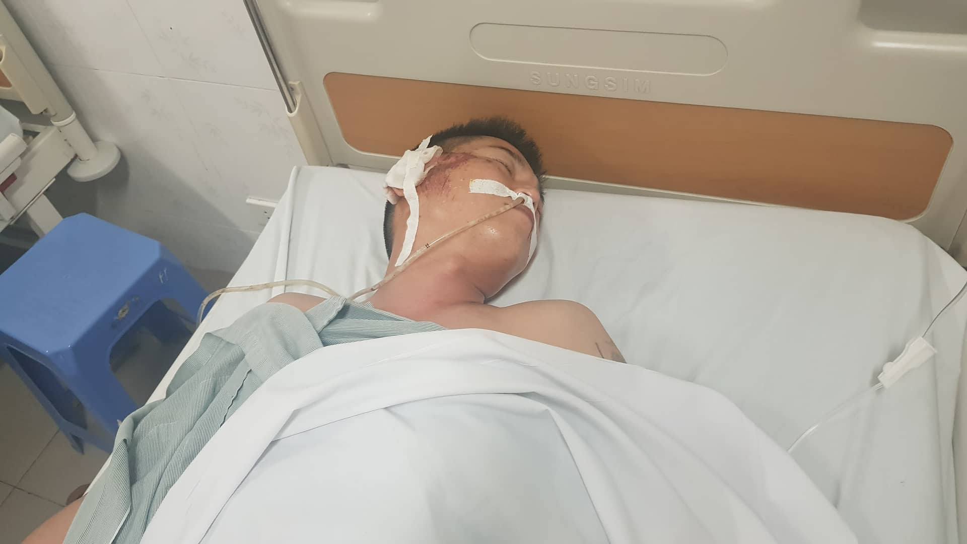 Vợ tài xế taxi kể khoảnh khắc chồng bị xe Mazda chèn qua người