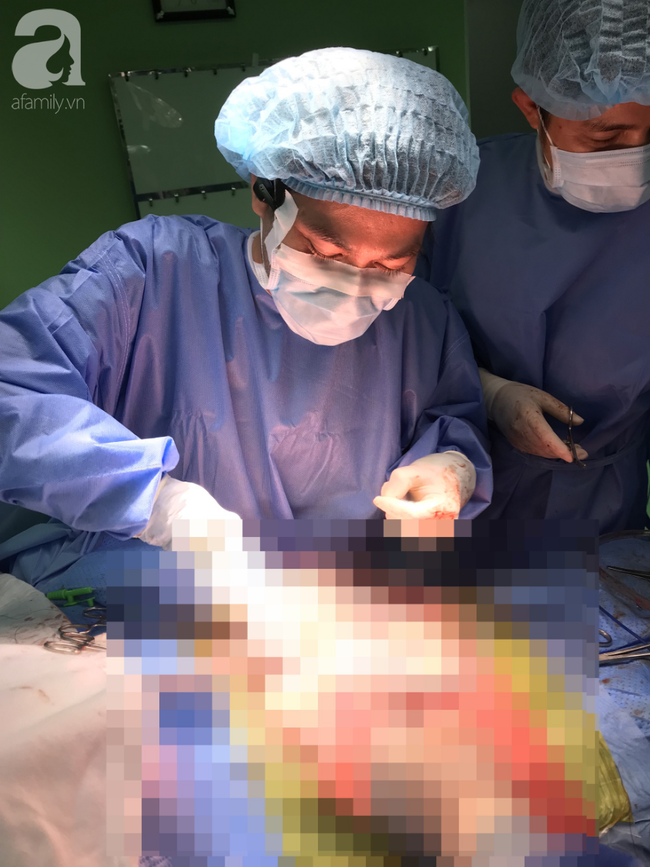 Cẩn thận với loại quả giòn ngon giàu dinh dưỡng này, đã có nhiều người bị tắc ruột chỉ vì ăn không đúng cách