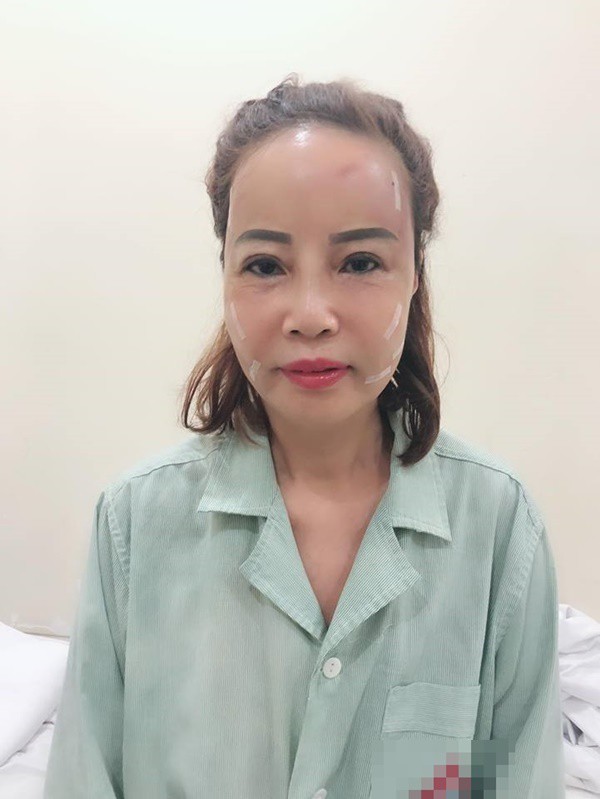 Ham livestream, cô dâu 62 tuổi lộ rõ vẻ già nua, dân mạng nghi ngờ ảnh thẩm mỹ chỉ làm màu để bán hàng online