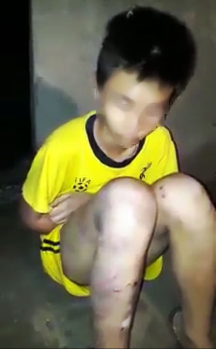 Nam sinh lớp 9 bị cha đánh đập dã man vì dùng ma túy: Có hai thanh niên kề dao vào cổ ép cháu chơi, còn dọa sẽ giết cả nhà