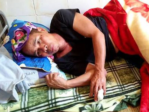 Lợn rừng một tạ húc người dân trọng thương