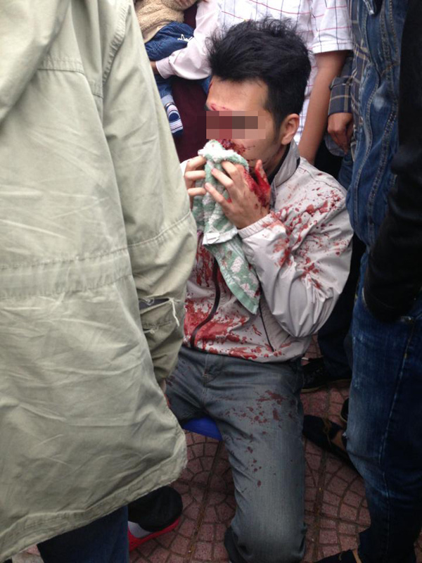 Tội nghiệp cô gái ấy: Đòi được 1 triệu đã cho vay 3 năm, chính chủ bị bạn thân 13 năm đánh thừa sống thiếu chết