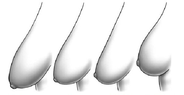 Ngực quả mướp và những lầm tưởng của hầu hết mọi người