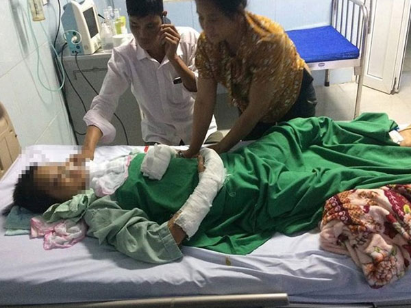 Bé gái 14 tuổi bị hàng xóm 13 tuổi cưỡng hiếp, cắt cổ đối mặt nguy cơ sang chấn tâm lý nặng