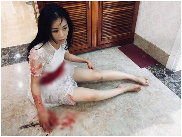 Quỳnh Búp Bê: Lộ ảnh Nghĩa - Quỳnh bê bết máu, nghi bị My Sói xử đẹp cả đôi