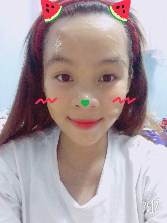 Nỗi khổ bất tận của những cô nàng có trán sân bay: Trán đi trước, người lả lướt theo sau!