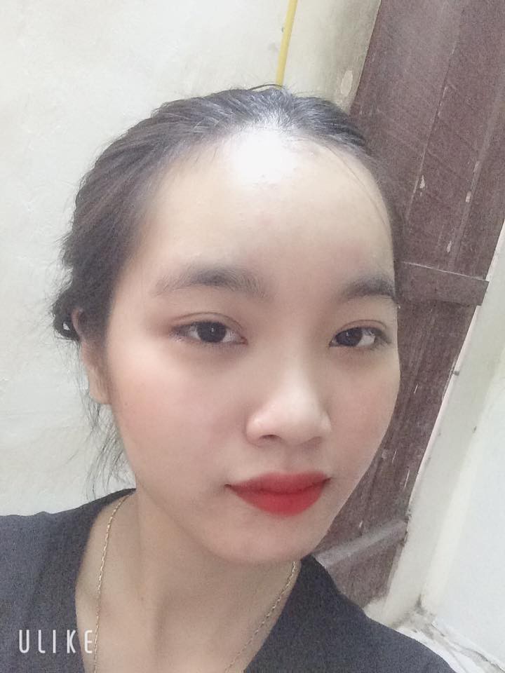 Nỗi khổ bất tận của những cô nàng có trán sân bay: Trán đi trước, người lả lướt theo sau!