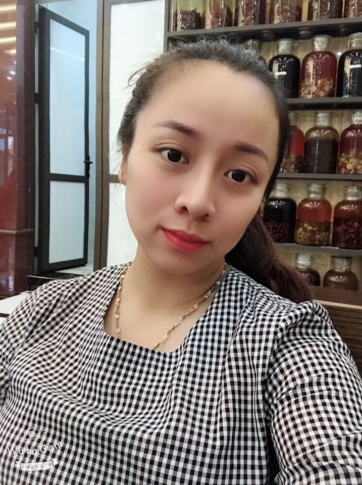 Nỗi khổ bất tận của những cô nàng có trán sân bay: Trán đi trước, người lả lướt theo sau!