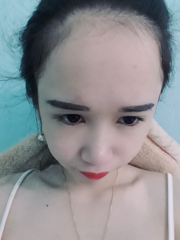 Nỗi khổ bất tận của những cô nàng có trán sân bay: Trán đi trước, người lả lướt theo sau!