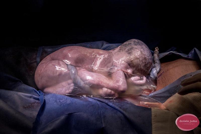 14 khoảnh khắc sinh con chất lừ, mẹ sẽ không hối hận khi xem!