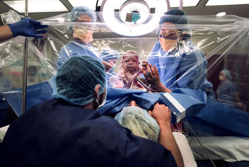 14 khoảnh khắc sinh con chất lừ, mẹ sẽ không hối hận khi xem!