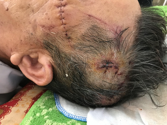 Cụ ông 74 tuổi kể lại giây phút vật lộn sinh tử với kẻ sát hại nữ giáo viên già ở Hưng Yên