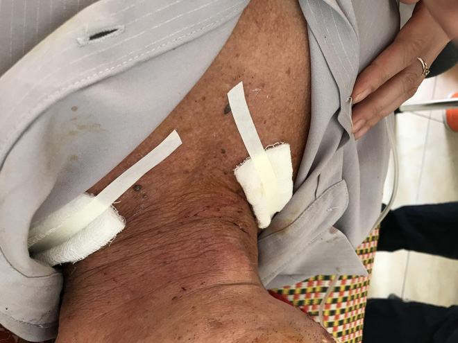 Cụ ông 74 tuổi kể lại giây phút vật lộn sinh tử với kẻ sát hại nữ giáo viên già ở Hưng Yên