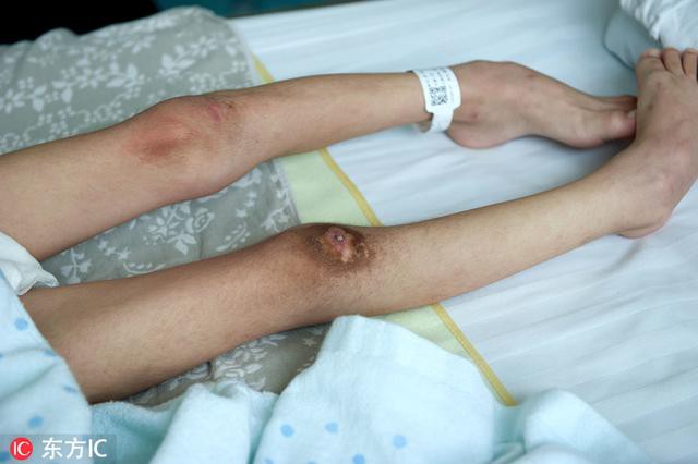 Nhận được điện thoại từ chồng cũ, người mẹ chạy đến bệnh viện và gục ngã khi biết con trai bị bạo hành đến thân tàn ma dại Nhận được điện thoại từ chồng cũ, người mẹ chạy đến bệnh viện và gục ngã khi biết con trai bị bạo hành đến thân tàn ma dại