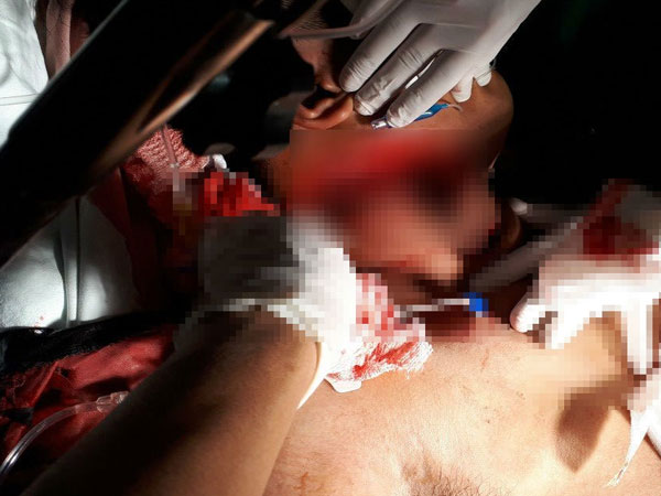 Vụ cuồng ghen ở Củ Chi: Hung thủ ra tay tàn độc với em vợ