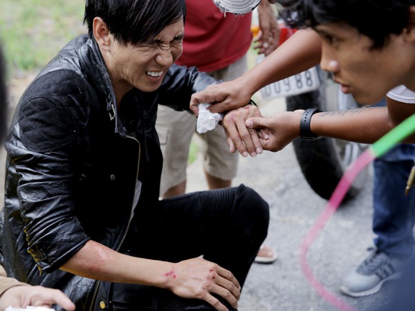 Sao Việt và những lần gặp tai nạn nghiêm trọng: Gãy xương, suy giảm thị lực nhưng vẫn chưa phải điều kinh khủng nhất