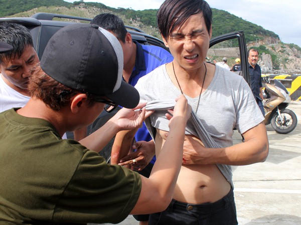 Sao Việt và những lần gặp tai nạn nghiêm trọng: Gãy xương, suy giảm thị lực nhưng vẫn chưa phải điều kinh khủng nhất