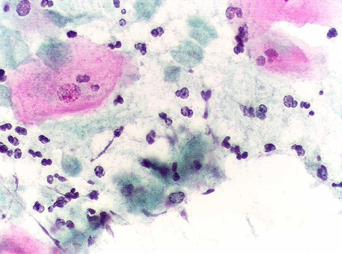 Nấm Candida sinh dục