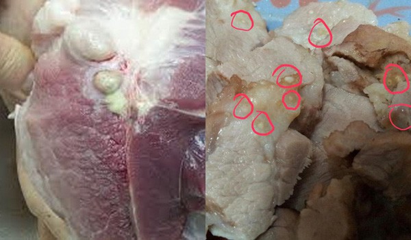 Đâu chỉ do ăn phải thịt lợn gạo, những kiểu ăn uống này cũng dễ khiến bạn bị cả búi sán làm tổ trong người!