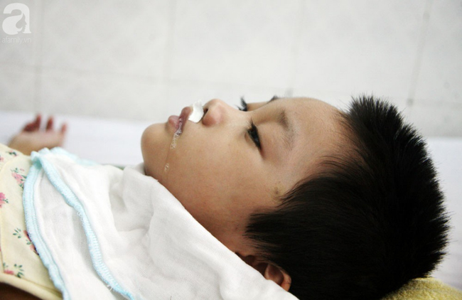 Bé gái 5 tuổi bị viêm màng não tự miễn sau cơn co giật, hơn 1 tháng không thể ngủ và liên tục la hét