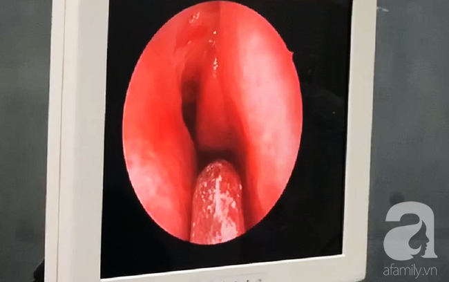 Đang đứng trước cửa nhà, người phụ nữ 32 tuổi bị viên đạn ghim thẳng vào mắt, suýt mù vĩnh viễn