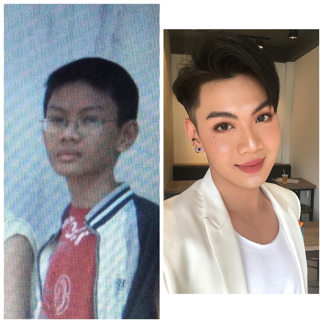 Đào Bá Lộc tự tin đăng ảnh ngày nhỏ để chứng minh dậy thì không phẫu thuật