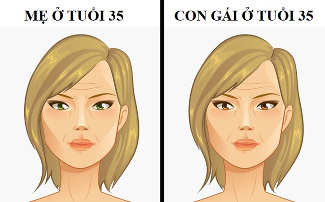 Con gái có thể mắc bệnh di truyền nào từ mẹ?