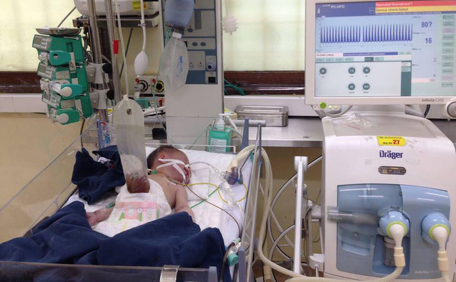 Chồng đỡ đẻ cho vợ tại nhà đau đớn phát hiện con gái bị lòi ruột ngoài bụng