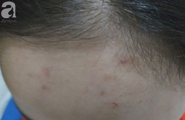 Hà Nội: Nữ sinh lớp 9 tố bị vợ hai của bố đập đầu, đánh tới mức phải nhập viện