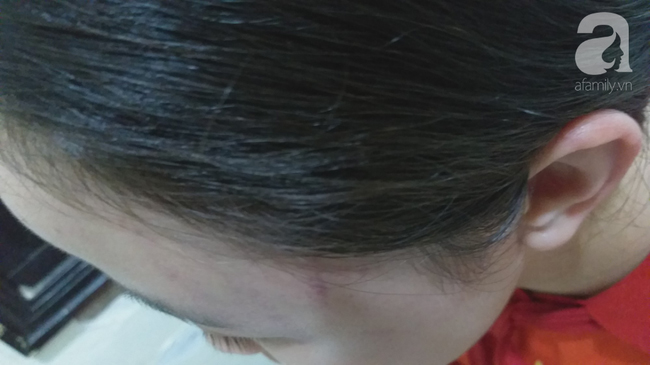 Nữ sinh lớp 9 kể lại giây phút bị vợ hai của bố túm tóc đập đầu xuống nền nhà