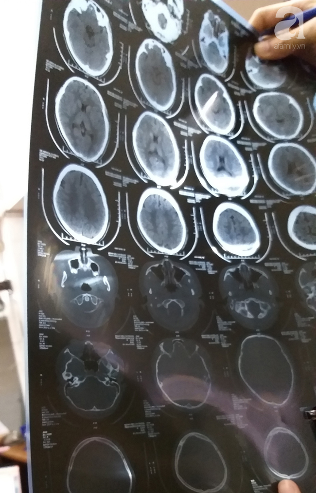 Nữ sinh lớp 9 kể lại giây phút bị vợ hai của bố túm tóc đập đầu xuống nền nhà