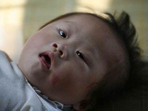 Con 8 tháng được chẩn đoán bại não chỉ vì ngày nào mẹ cũng đặt thứ này dưới gối