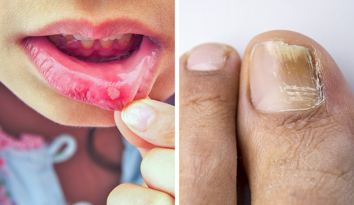 Đây là những điều bác sĩ không bao giờ nói ra khi kê kháng sinh