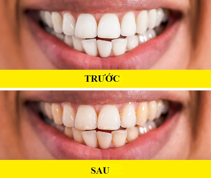 Đây là những điều bác sĩ không bao giờ nói ra khi kê kháng sinh