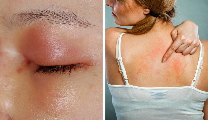 Đây là những điều bác sĩ không bao giờ nói ra khi kê kháng sinh