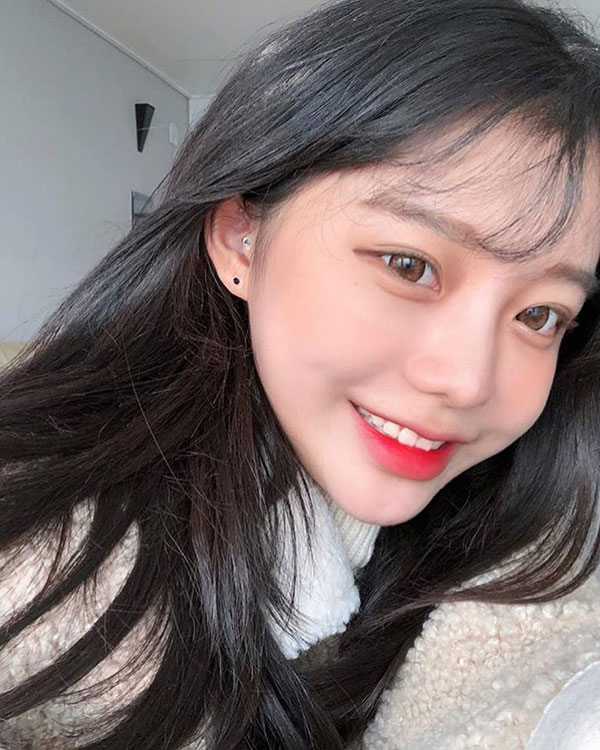 Ai cũng từng bị mụn nhưng làm sao để tránh thâm, sẹo thì bạn sẽ cần đến 5 lời khuyên tuyệt vời này từ bác sĩ