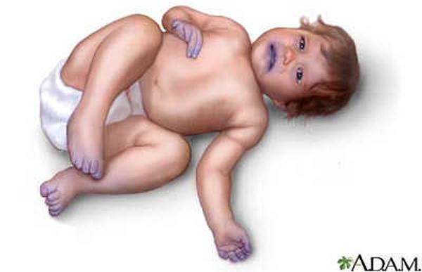 Hốt hoảng khi tay chân con tím ngắt, nhìn vào bữa ăn mẹ chuẩn bị liền hiểu lý do Hốt hoảng khi tay chân con tím ngắt, nhìn vào bữa ăn mẹ chuẩn bị liền hiểu lý do