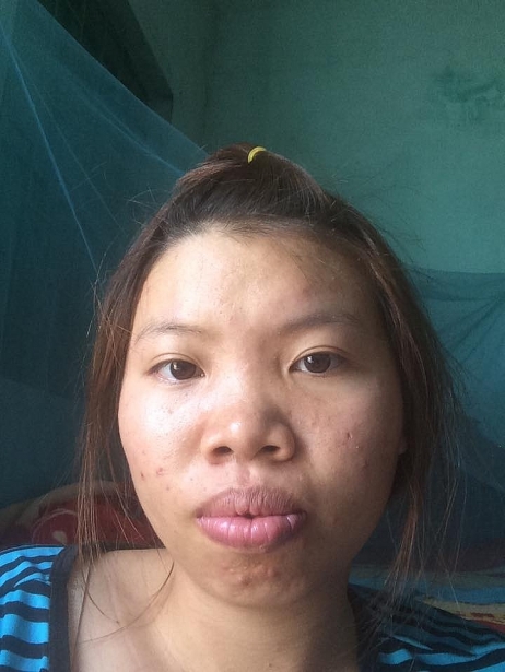 Ai cũng tưởng Phượng Thị Nở là ca thẩm mỹ lột xác thành công nhất nhưng so với 2 người này chưa là gì