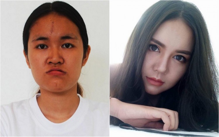 Ai cũng tưởng Phượng Thị Nở là ca thẩm mỹ lột xác thành công nhất nhưng so với 2 người này chưa là gì