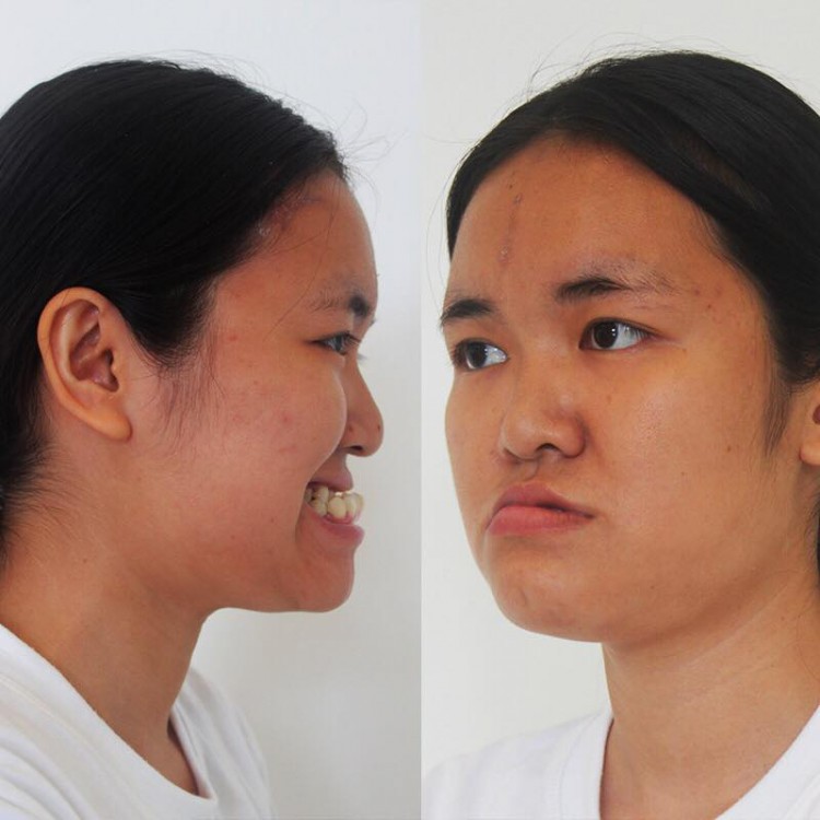 Ai cũng tưởng Phượng Thị Nở là ca thẩm mỹ lột xác thành công nhất nhưng so với 2 người này chưa là gì