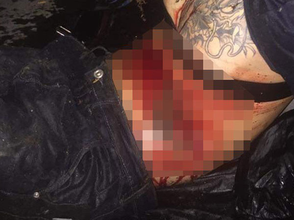 Hà Nội: Tên trộm nhảy xuống ao bỏ trốn, bị vật nhọn đâm thủng bụng