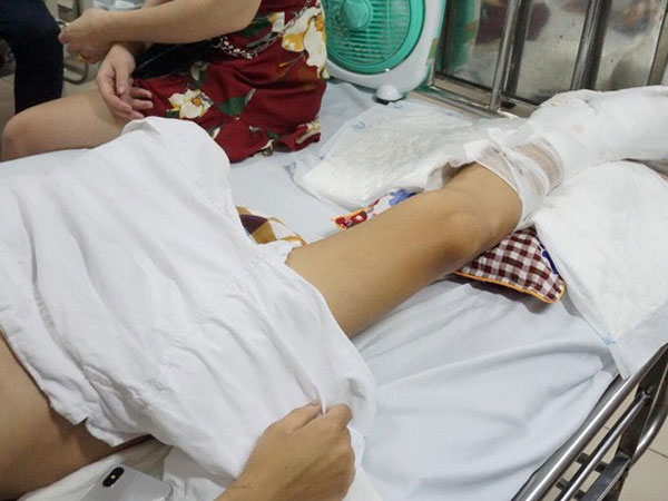 Kẻ cầm đầu nhóm côn đồ truy sát khiến nam thanh niên phải cưa chân khai gì?