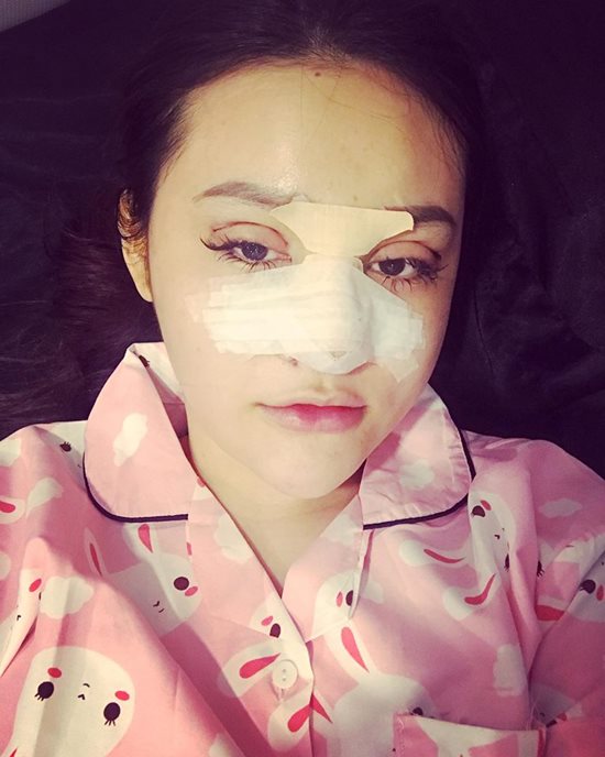 Hot girl từng náo loạn phố Nguyễn Huệ: Liên tục dao kéo vì bị gọi là Mặt vuông