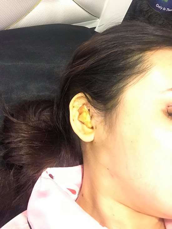 Hot girl từng náo loạn phố Nguyễn Huệ: Liên tục dao kéo vì bị gọi là Mặt vuông