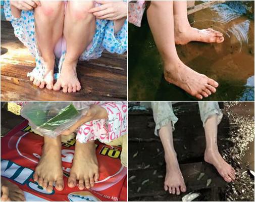 Đẹp như Ngọc Trinh, Hà Hồ, Minh Hằng cũng có khuyết điểm, dù chi tiền tỷ vẫn không thể cứu