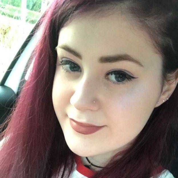 Chứng bệnh bất ngờ khiến cô gái 19 tuổi thấy mình như bà lão